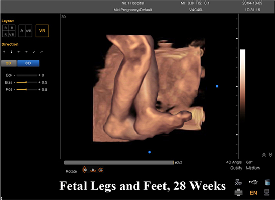 Quelles Sont Les Differences Entre Les Echographies 2d 3d Et 4d Forlong Medical